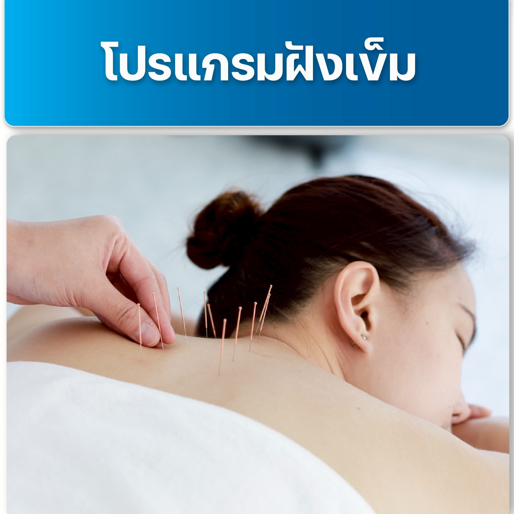 image โปรแกรมฝังเข็ม
