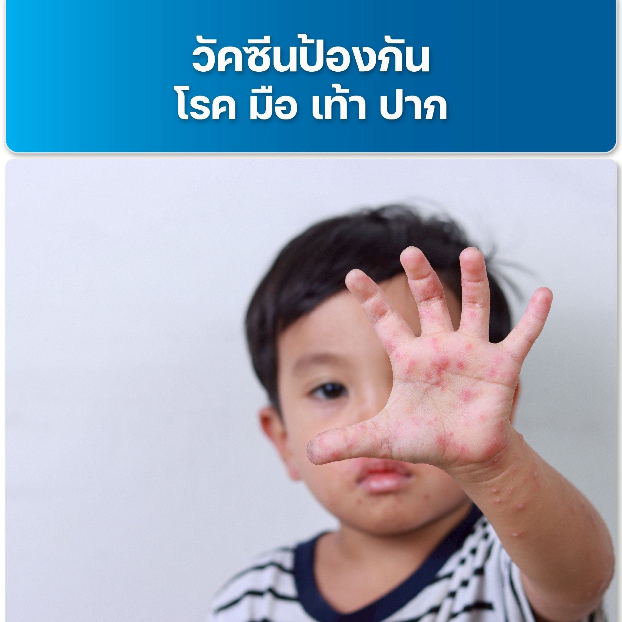 upload/package-promotion/package-promotion-31072025-181458.jpeg