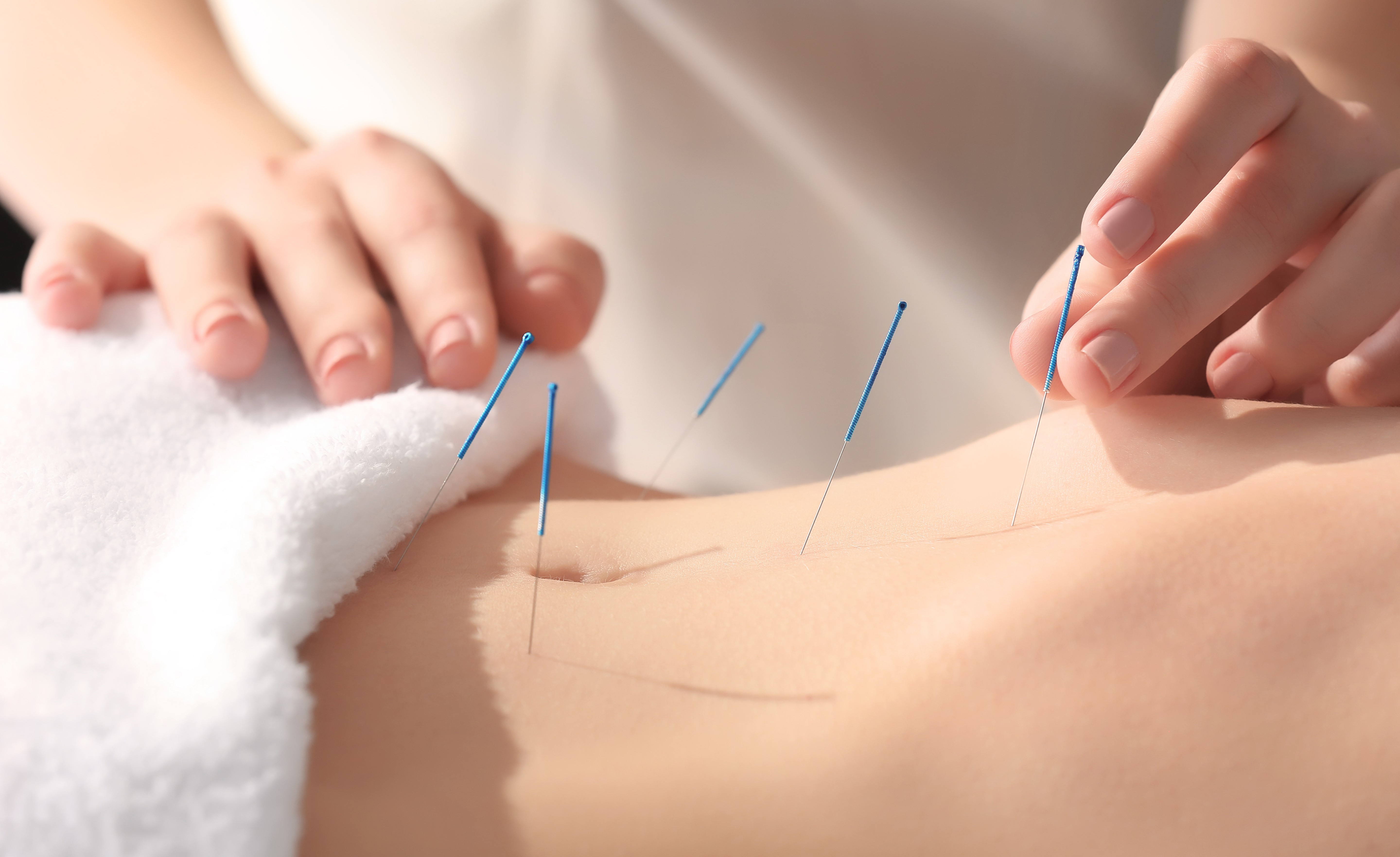 image Acupuncture Department